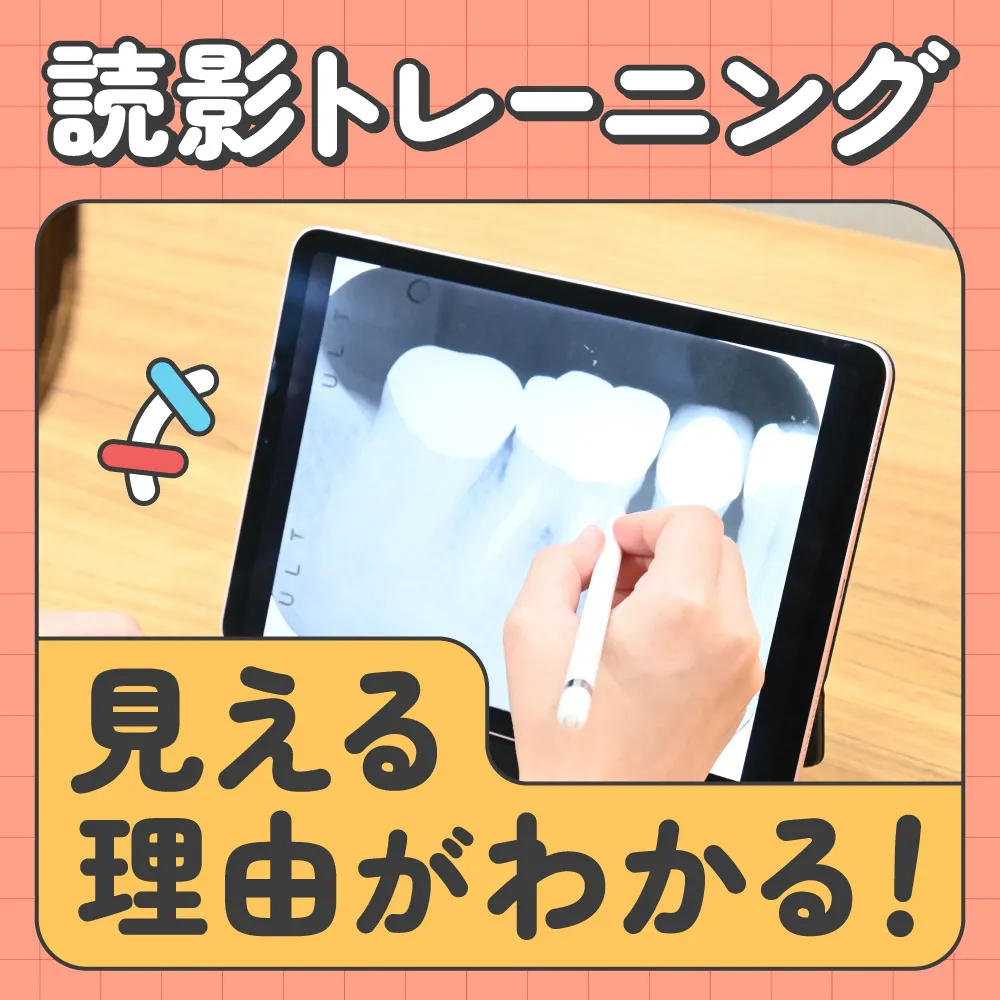 読影トレーニング