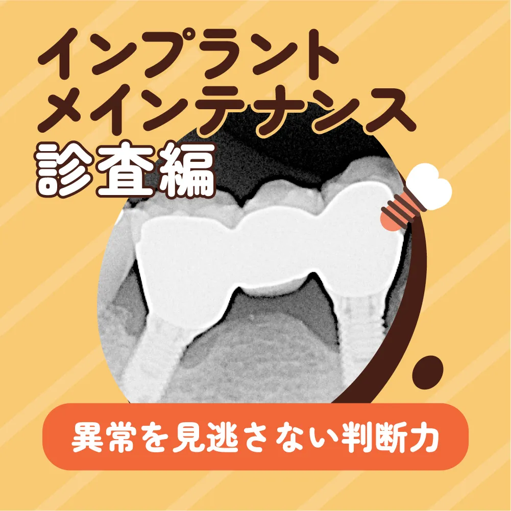インプラントメインテナンス -診査編-