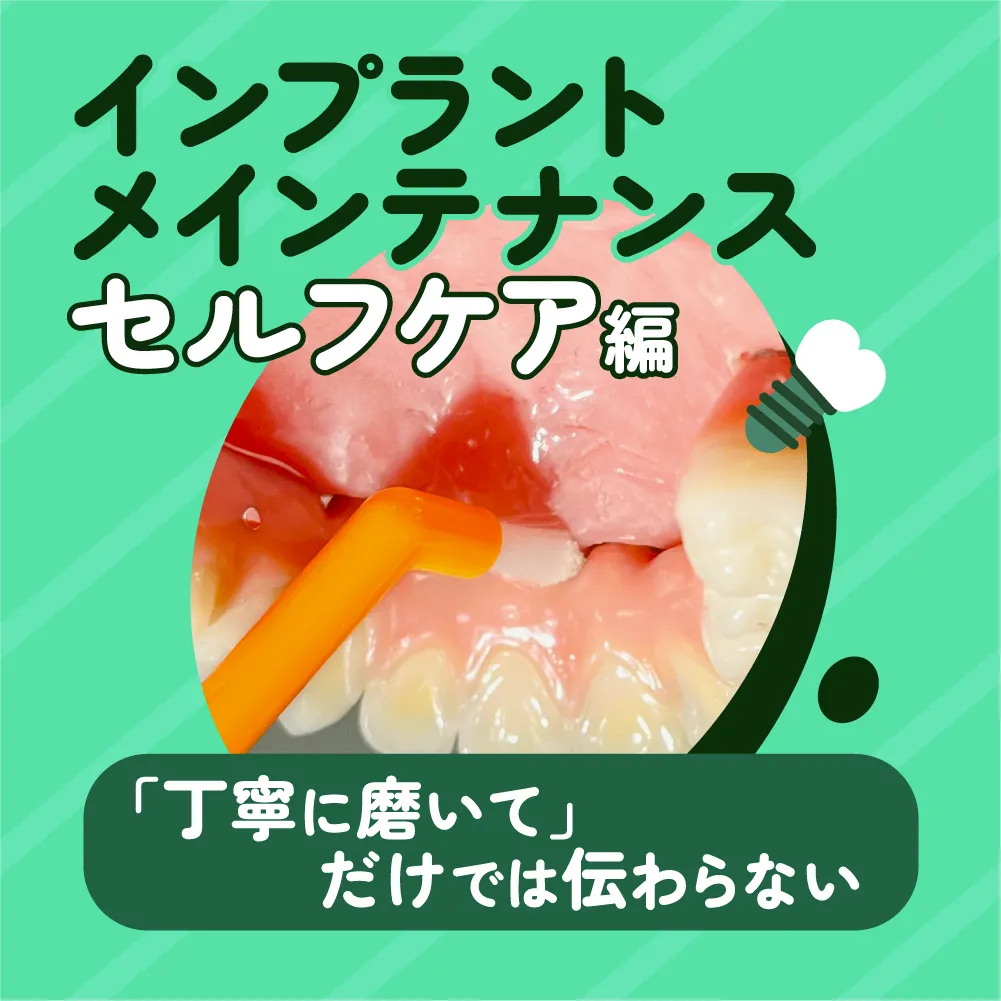 インプラントメインテナンス -セルフケア編-