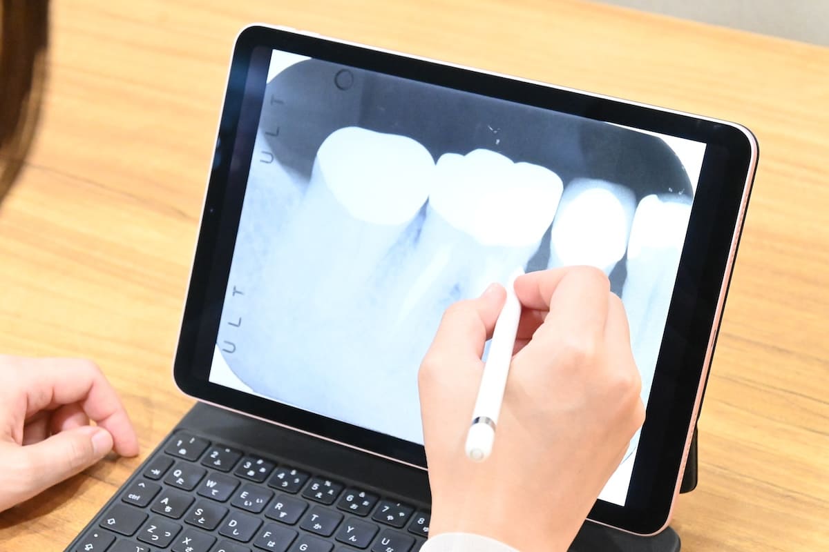 読影トレーニング