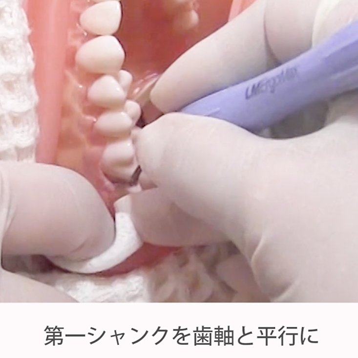 苦手をなくそうSRP 実践編 