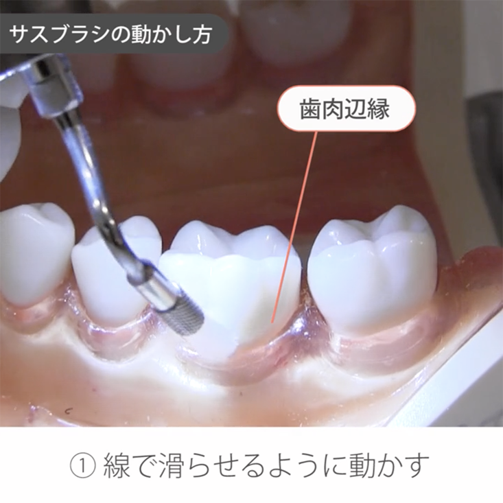サスブラシ 