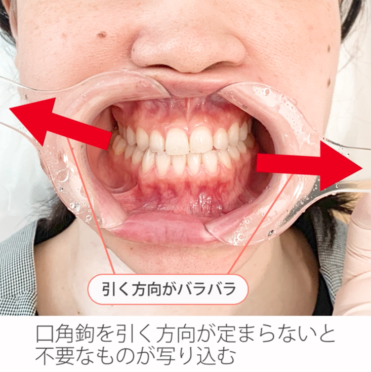 誰でも撮れるきれいで規格性のある口腔内写真 :20231101031138