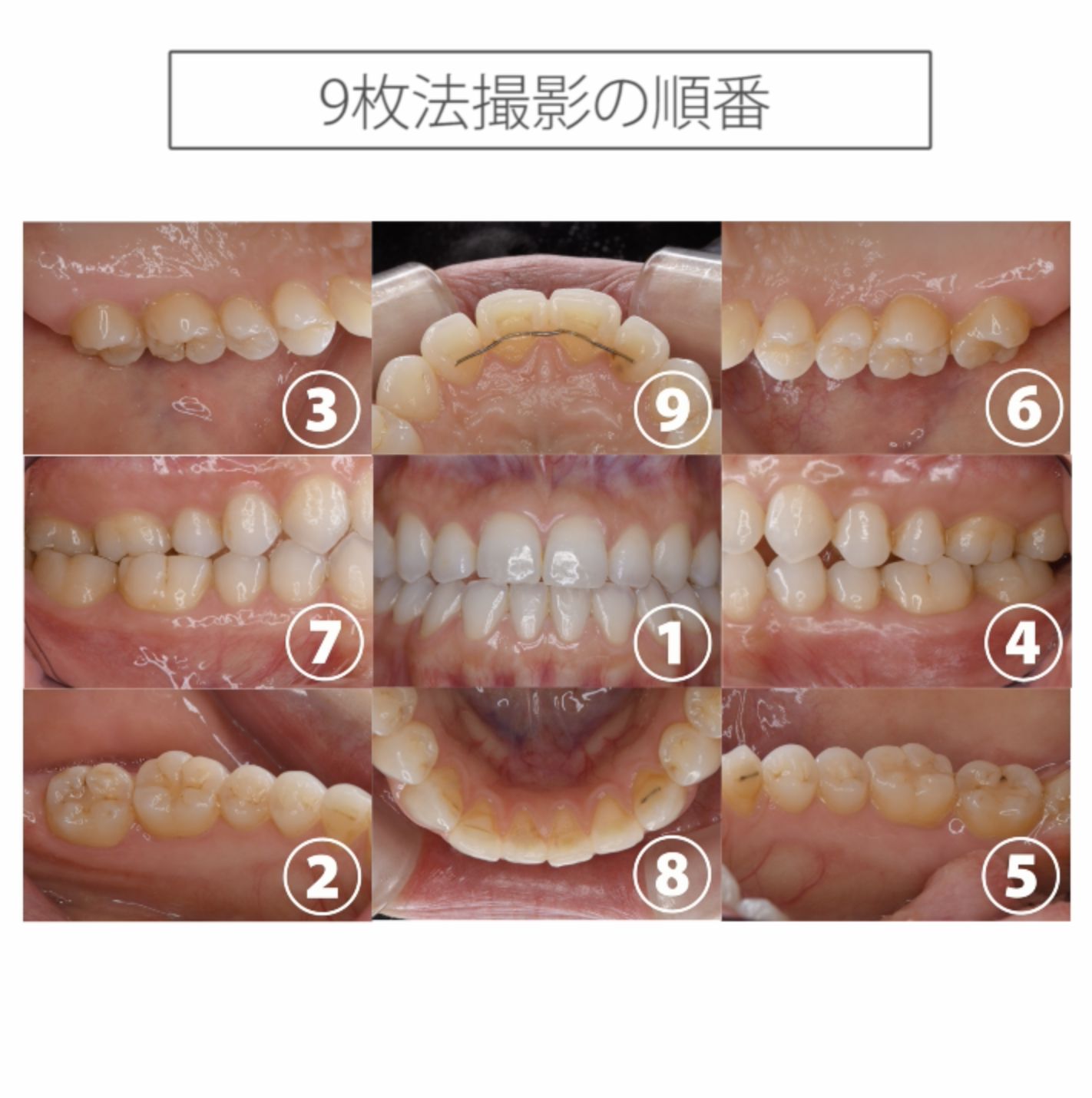 仰臥位