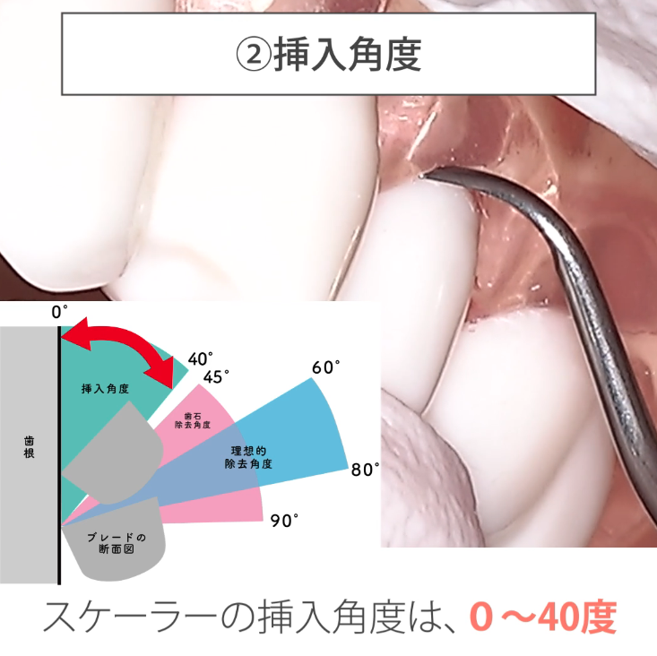 苦手をなくそうSRP 基礎編 12.挿入を理解する