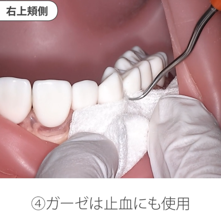 苦手をなくそうSRP 基礎編 14.優しい排除