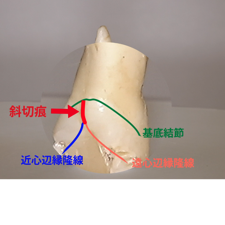 やさしい解剖学 08.斜切痕