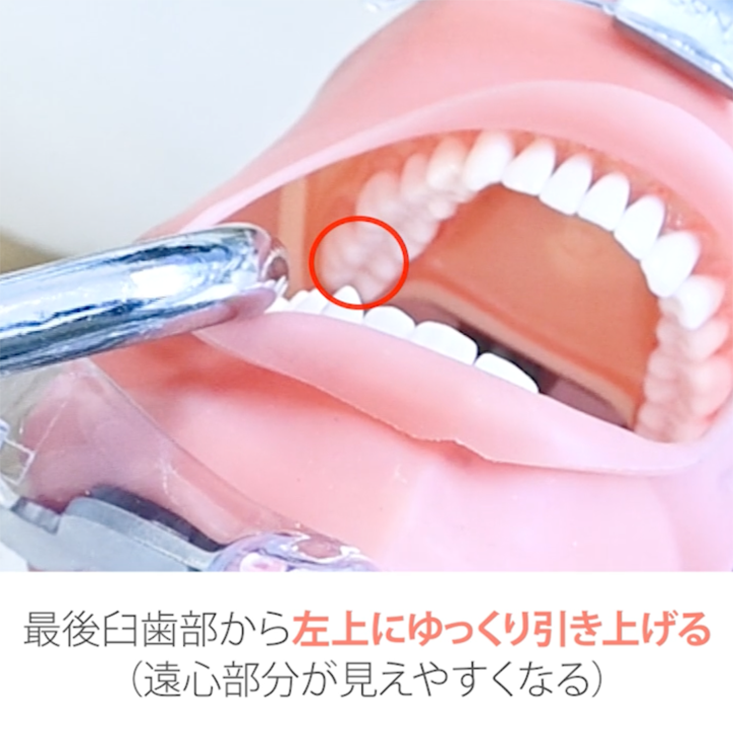 スケーリング実践編