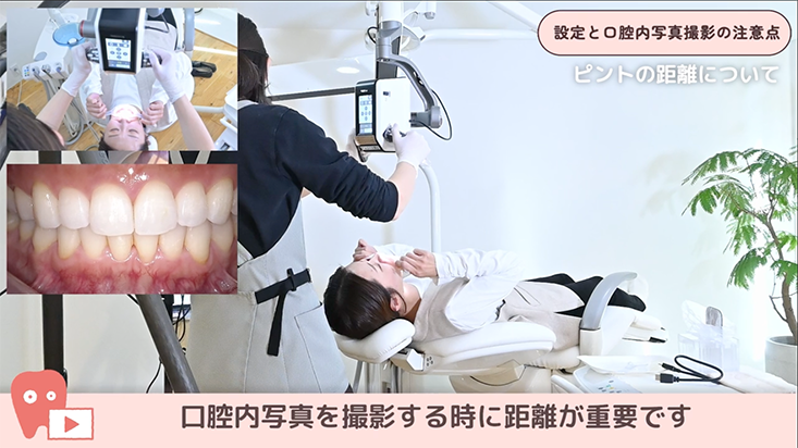 01.設定と口腔内写真撮影の注意点