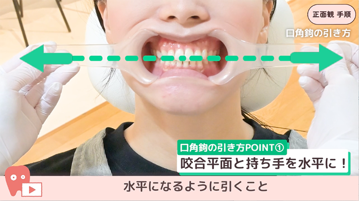 座位で撮る口腔内写真５枚法 04.正面観　手順　