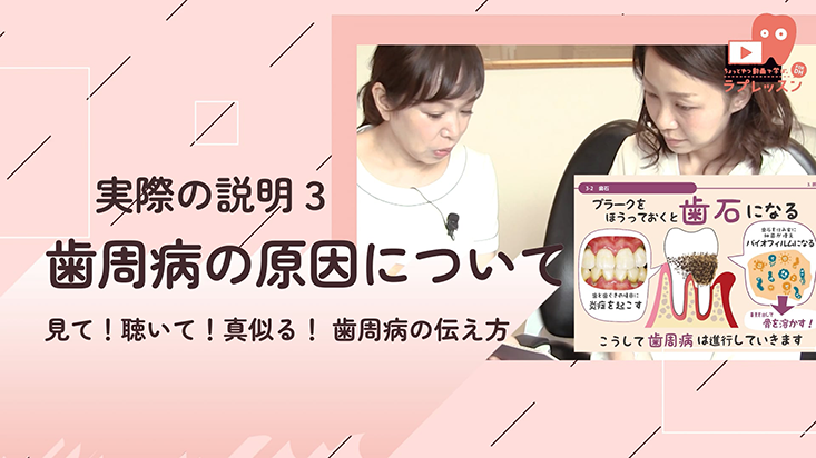 見て！聴いて！真似る！　歯周病の伝え方 03.実際の説明３　歯周病の原因について