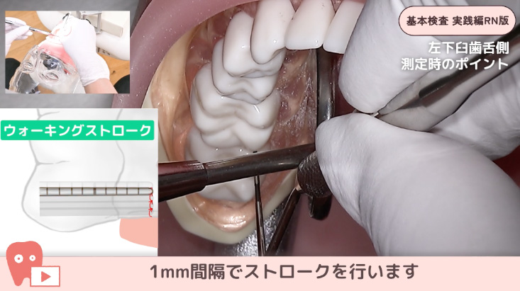 基本検査 実践編 リニューアル版 04.左下7-4