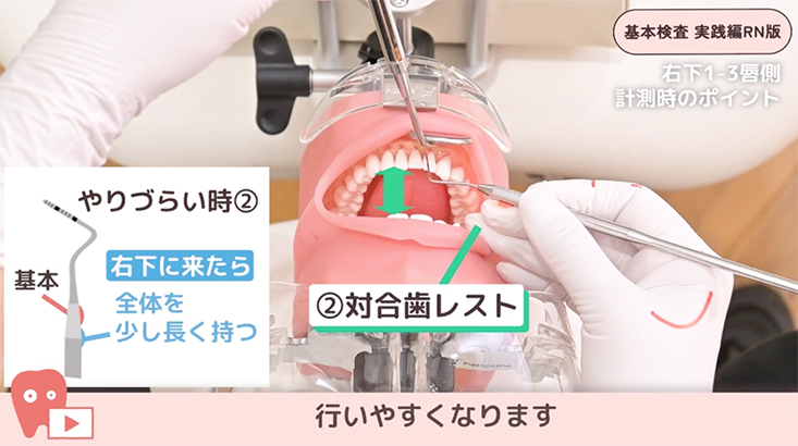 基本検査 実践編 リニューアル版 05.左下3-右下3