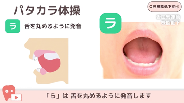 口腔機能低下症 04.舌口唇運動機能低下への対応-パタカラ体操、頬の膨らまし運動など-