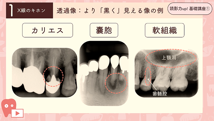 精密検査