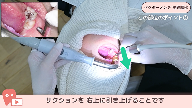 パウダーメインテナンス