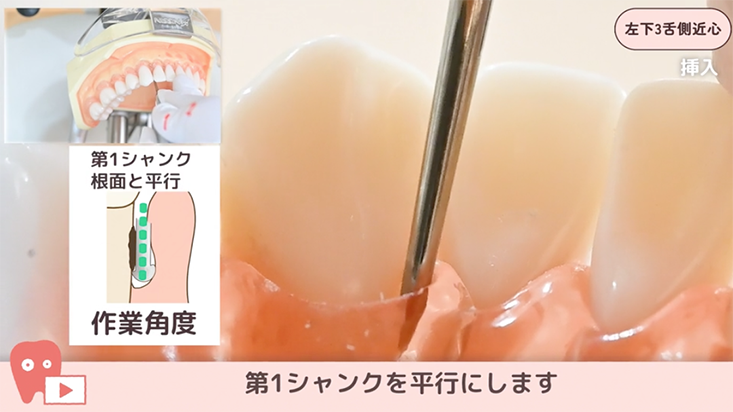 SRPレッスン