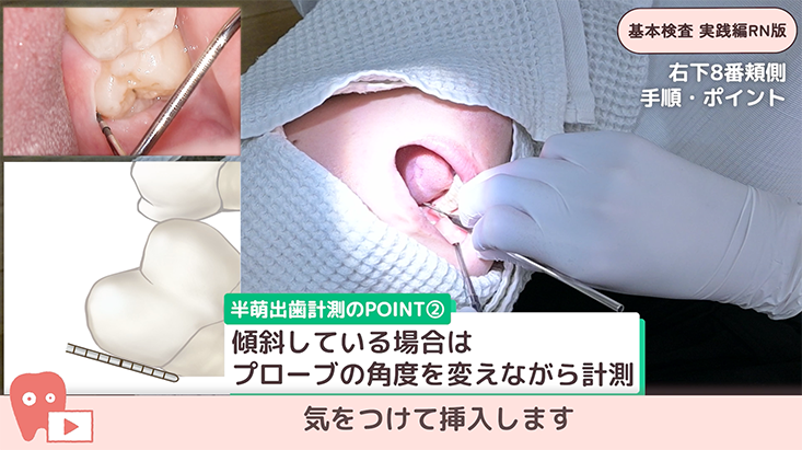 基本検査