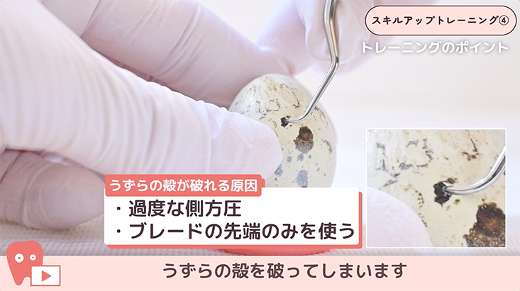 スキルアップトレーニング 04.SRPトレーニング -うずらの卵で親指側方圧トレーニング-