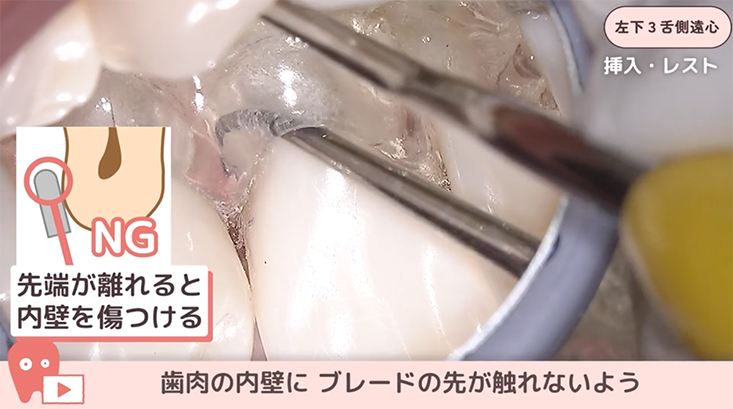 SRPレッスン