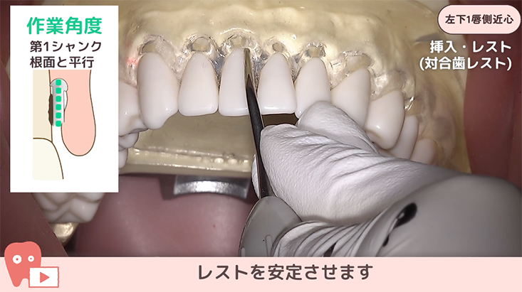 SRPレッスン