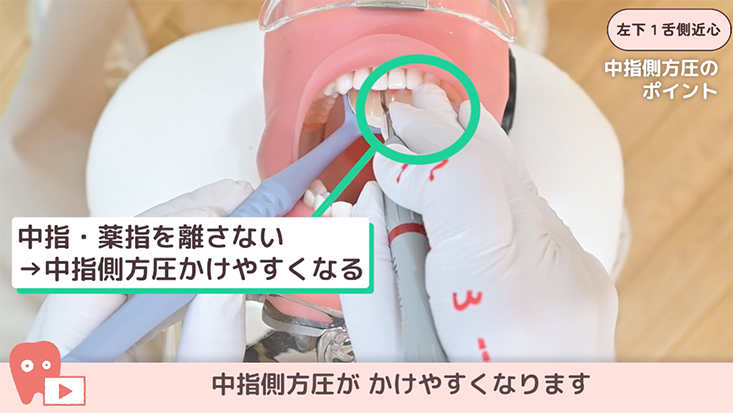 ☆SRPレッスン 下顎前歯部 ☆08.左下１舌側近心