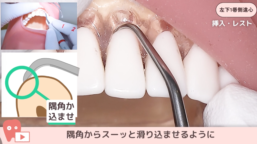 SRPレッスン