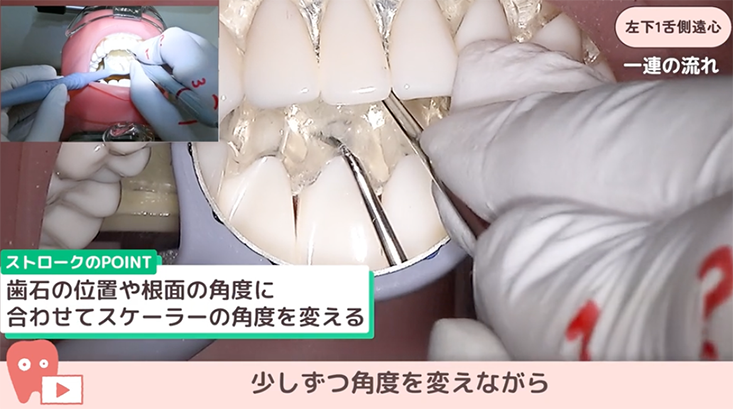 SRPレッスン