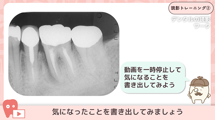 読影トレーニング"