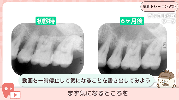 読影トレーニング"