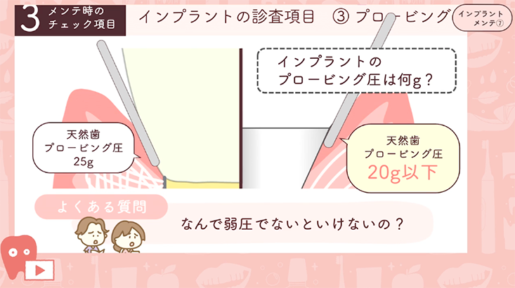 07.メインテナンス 診査編 ②-プロービング-