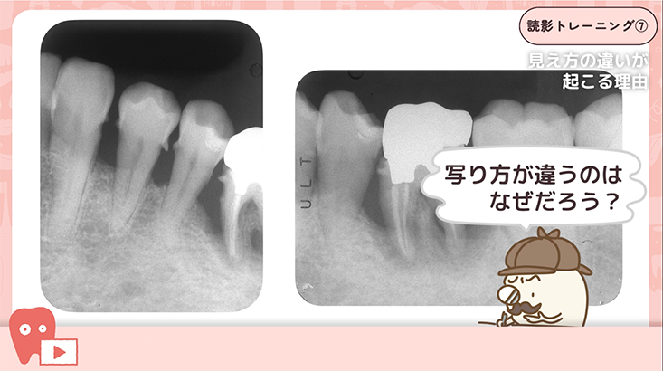 07.撮影角度による見え方の違い①