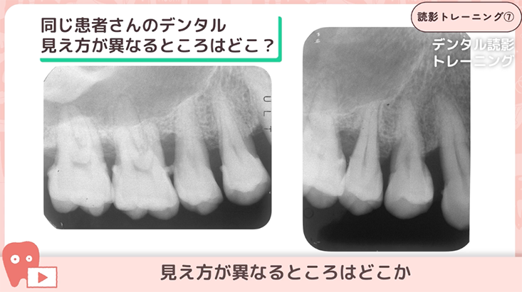 読影トレーニング"