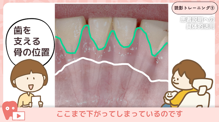 読影トレーニング"