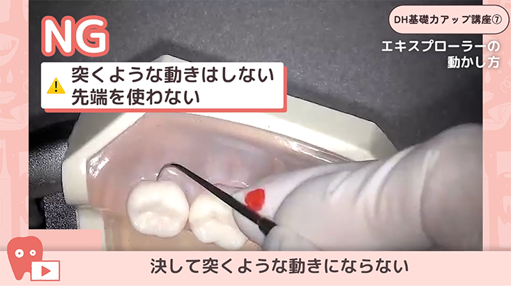 08.エキスプローリング②-レスト・動かし方・左下頬側のポジション-