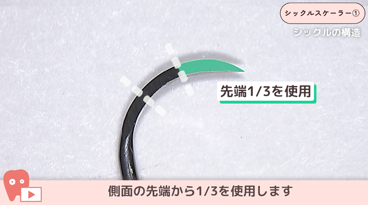 シックルスケーラー"