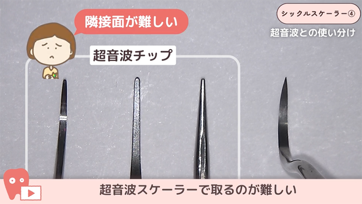 シックルスケーラー"