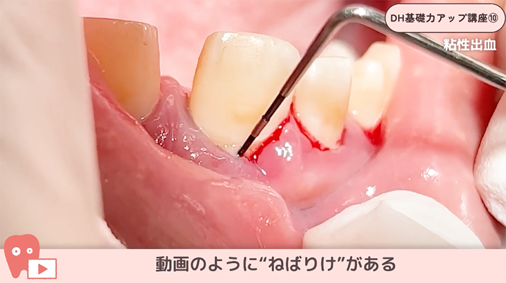 サクッと学ぶDH基礎力アップ講座"