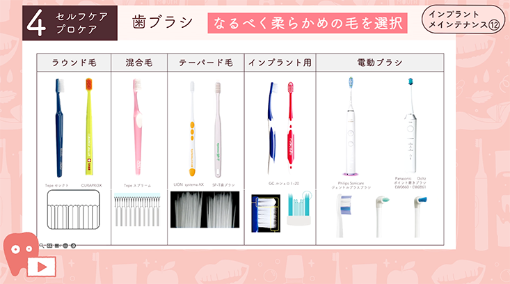 インプラントメインテナンス"