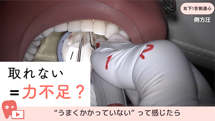 SRPレッスン