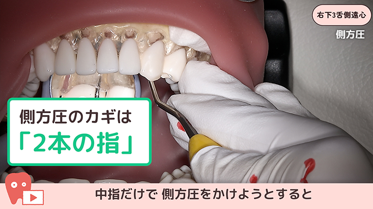 SRPレッスン